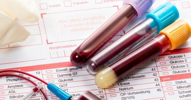 Εξέταση αίματος για τον ιό των ανθρωπίνων θηλωμάτων